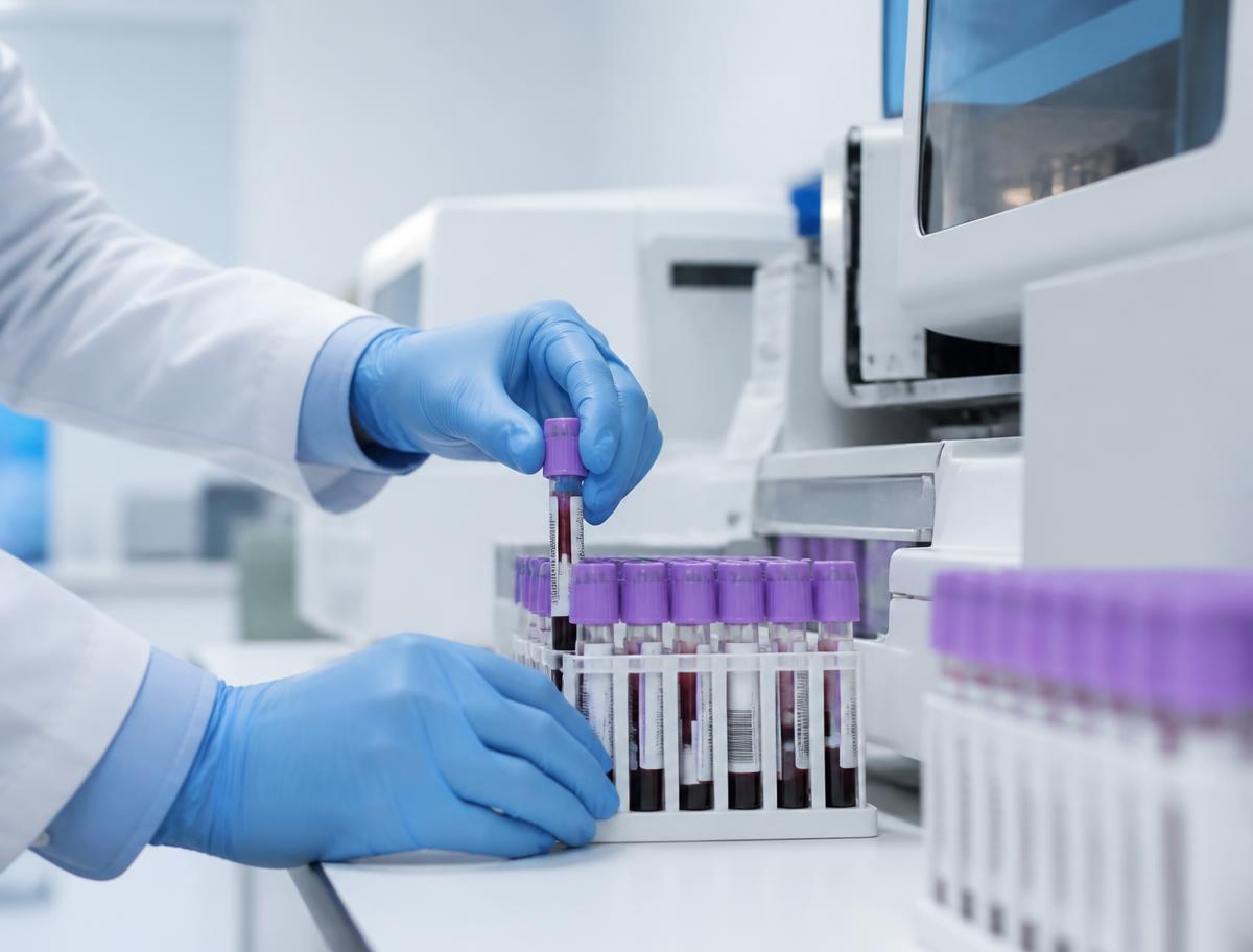 Blood sample tubes beside a laboratory analyzer